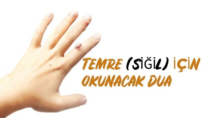 SİĞİL VE TEMRE İÇİN YAPILACAK İŞLEM VE DUALAR